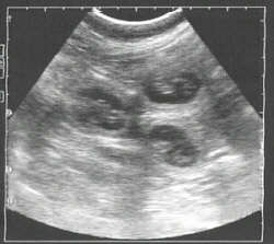Ultraschall Bild bei der Trächtigkeit der Hündin Looana